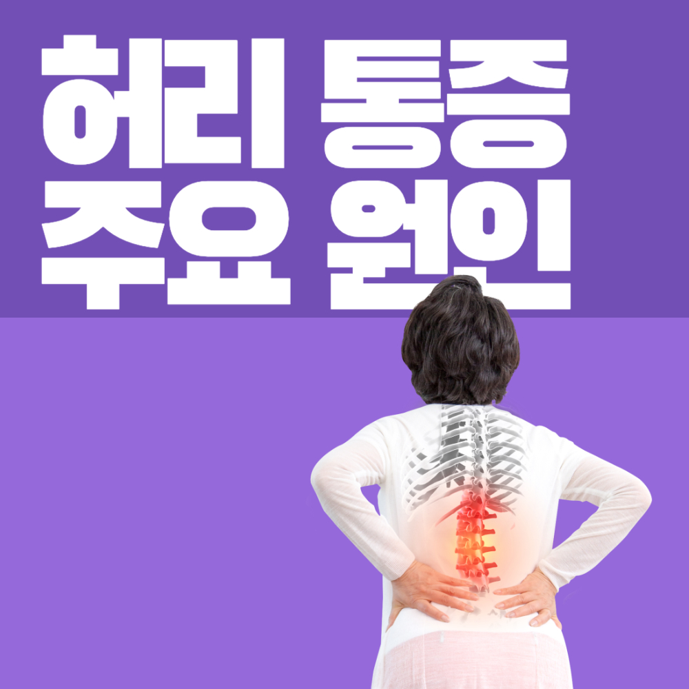 허리 통증 원인 대표 사진