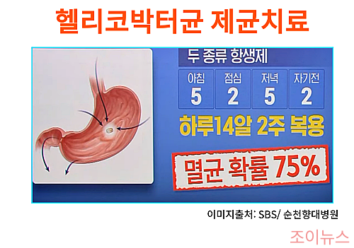 헬리코박터균의 제균치료