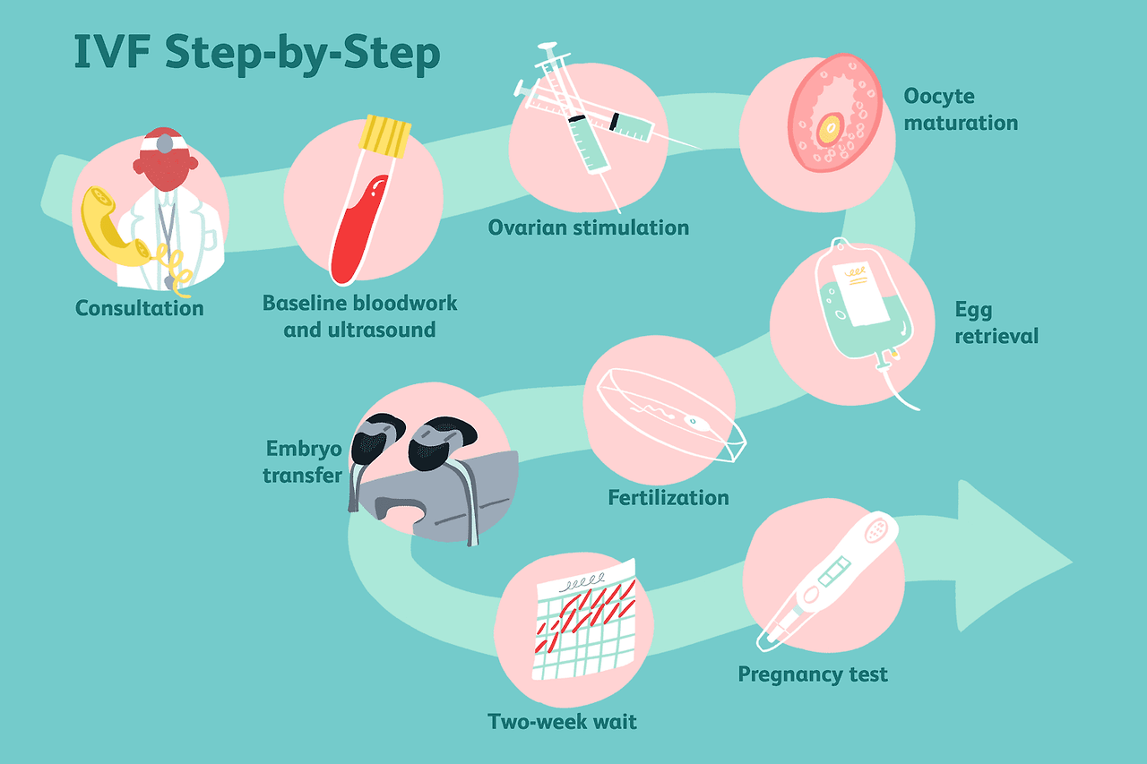 In vitro fertilization(IVF)
