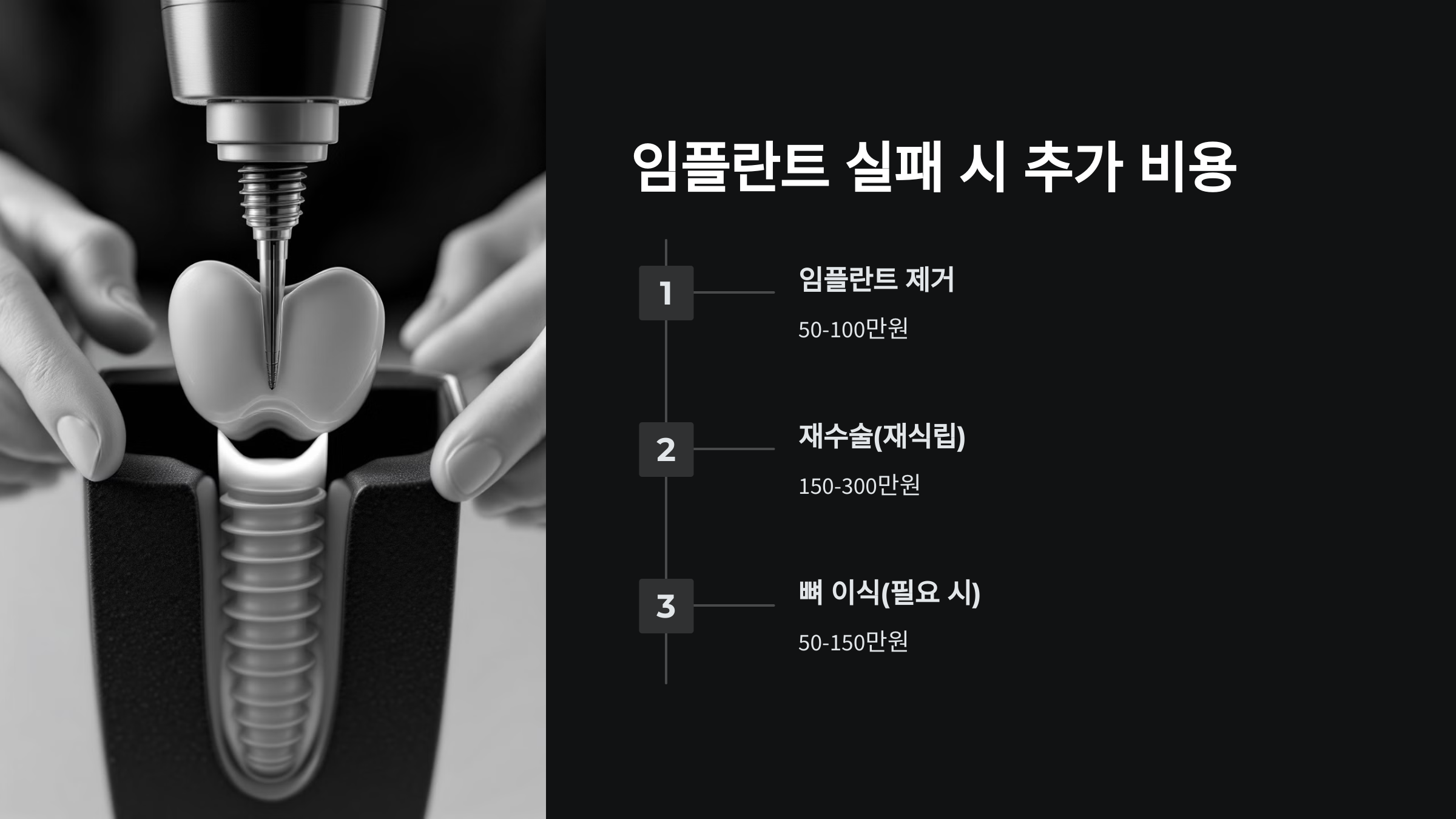 임플란트 실패 시 추가 비용