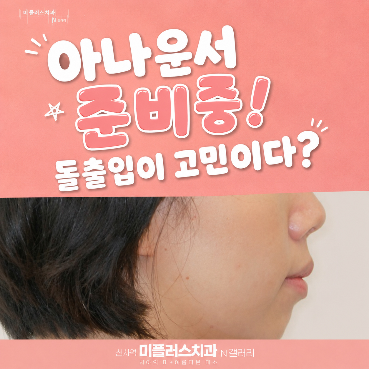돌출입 개선을 고민하는 환자의 교정 전 측면 모습
