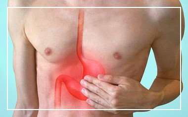 위식도 역류질환