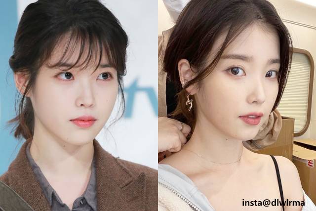 아이유 얼굴 하얘지는법,얼굴 하얘지는 시술,팁줌