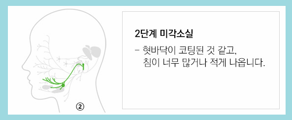말초성 안면마비 신경손상 단계 이미지