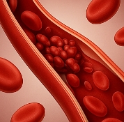 뇌경색 초기증상