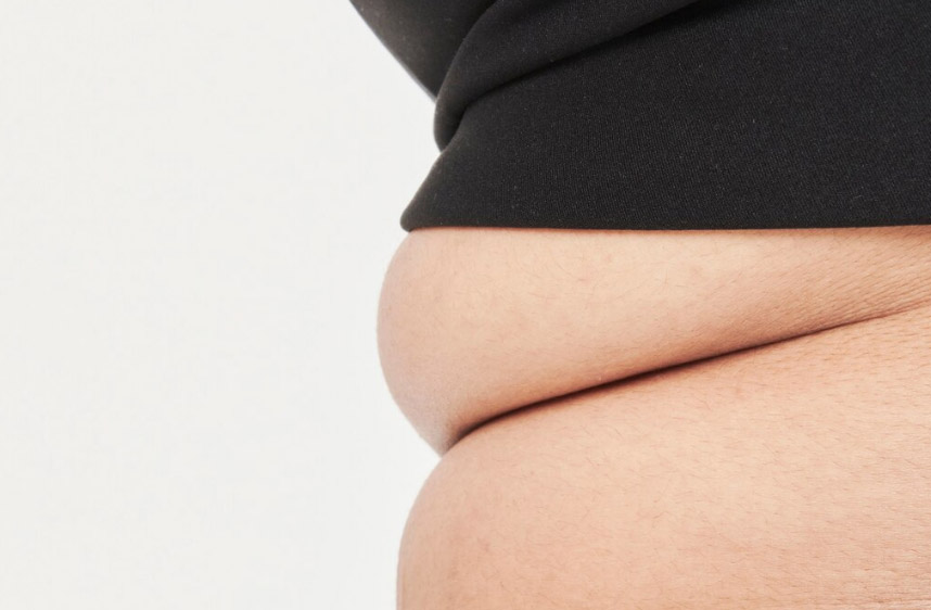 비만치료 위고비