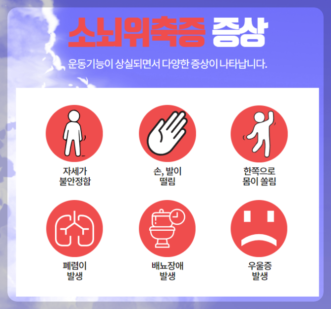 소뇌위축증 증상