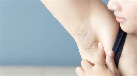 여자 겨드랑이 냄새