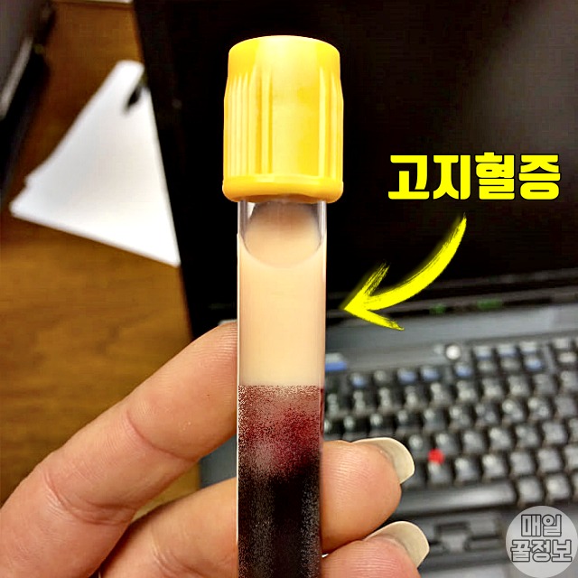 탁해진 피 고지혈증에 좋은 음식,팁줌