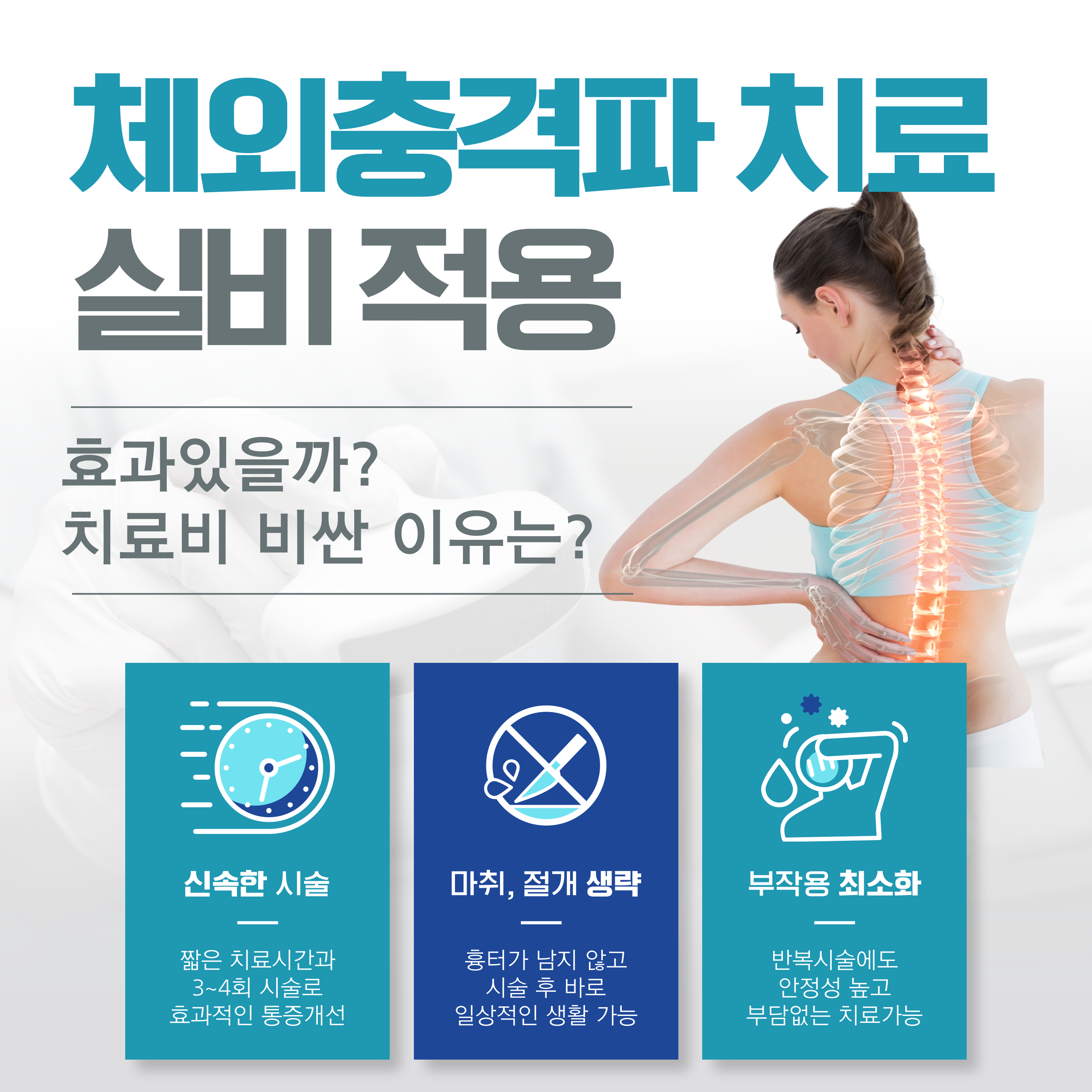 체외충격파 치료