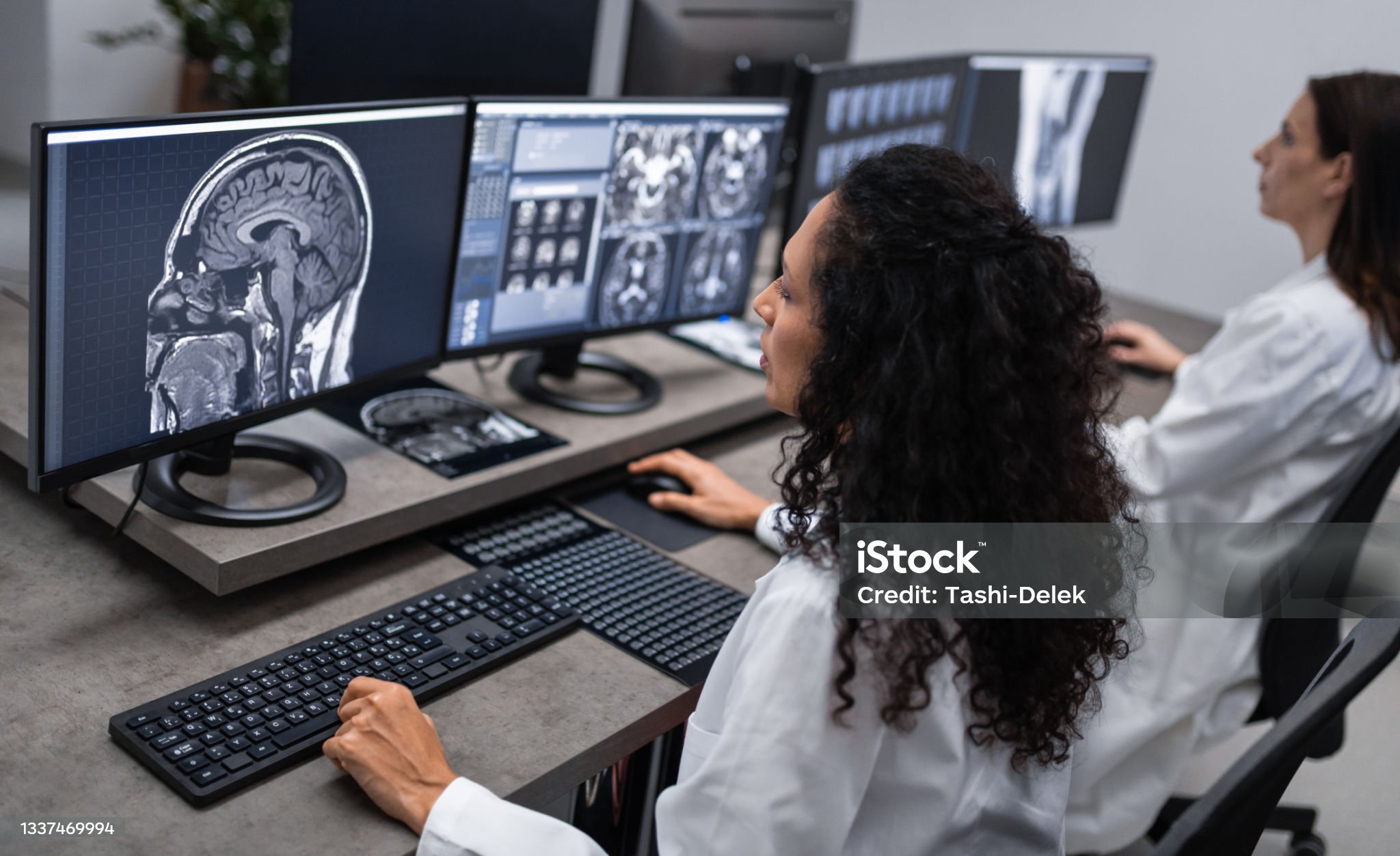 MRI의 신경계 질환 진단 적용 사례