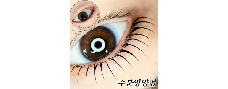 김해시 내성발톱