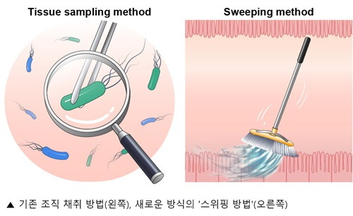 헬리코박터균 증상 치료 해결책