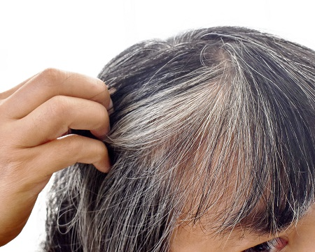 새치를 예방 관리