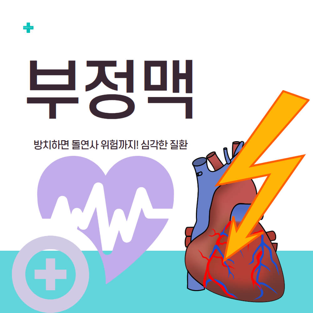 부정맥