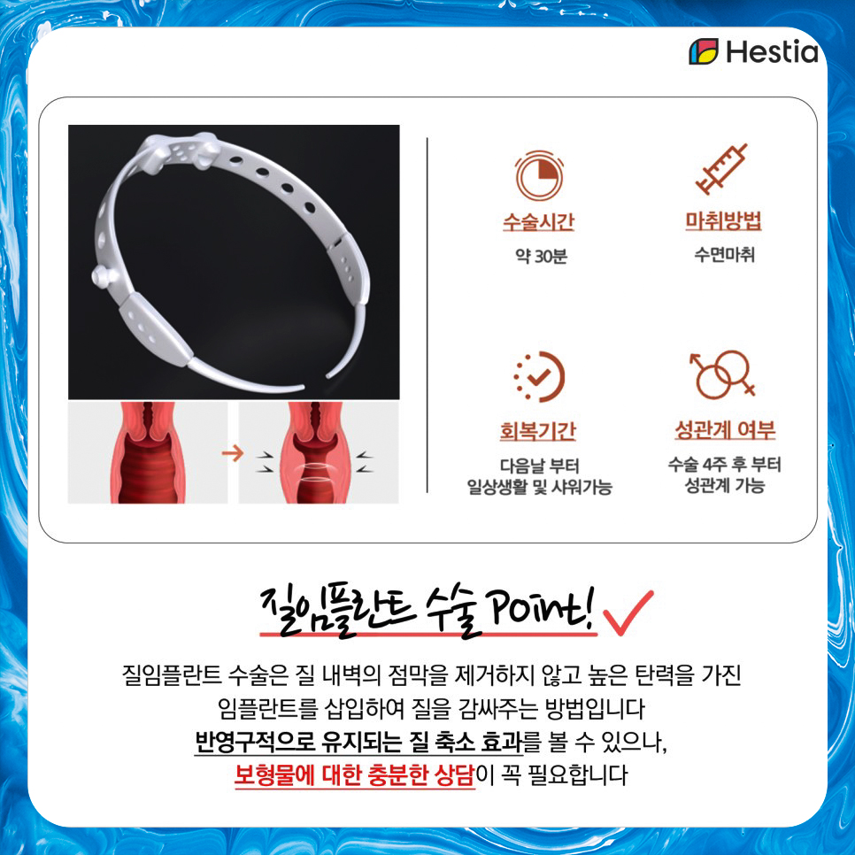 질임플란트