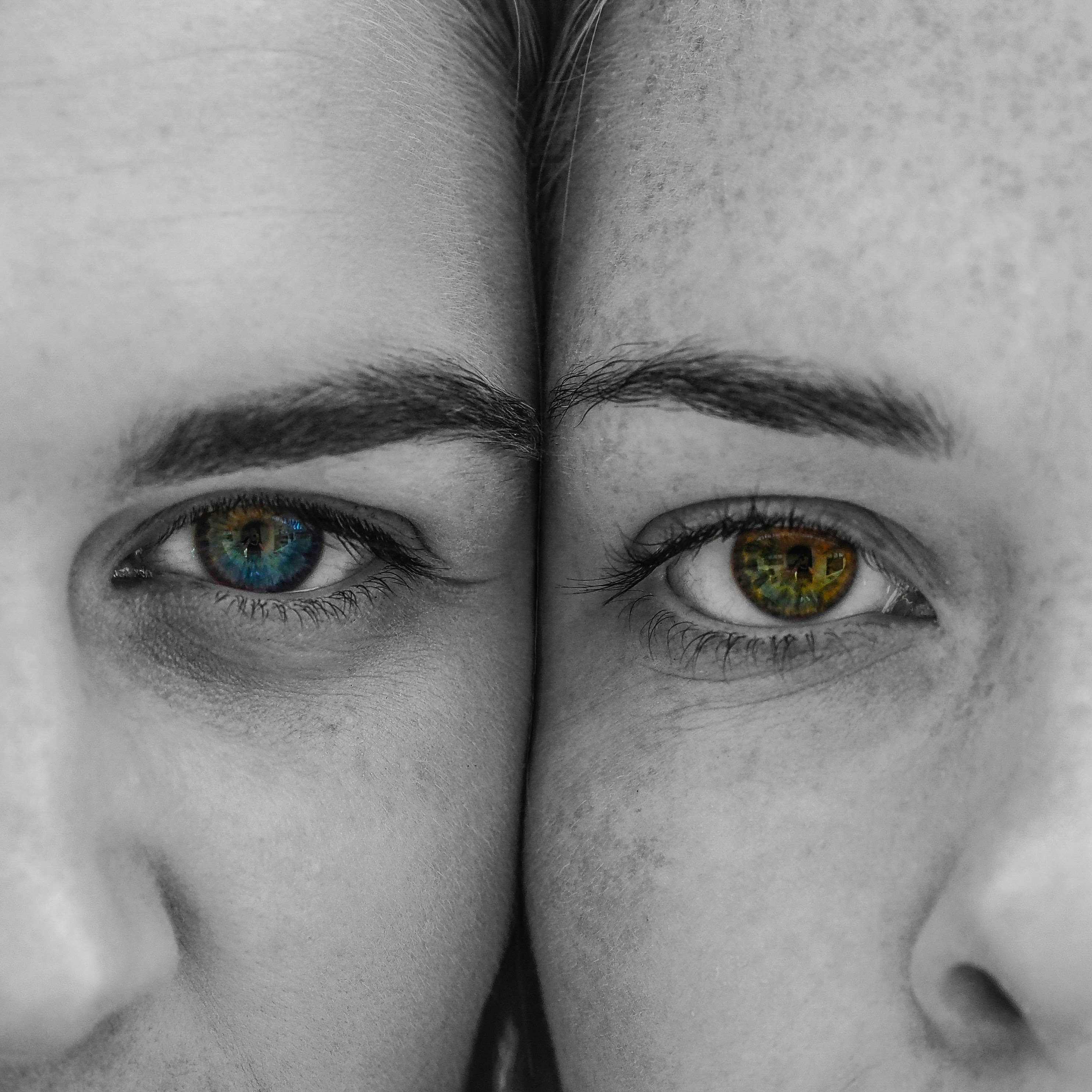 선천성 vs 후천성 안검하수