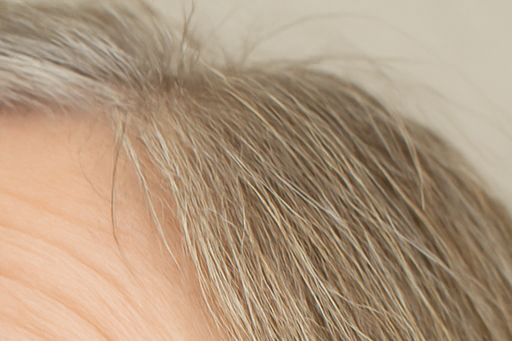 노안 교정 안약