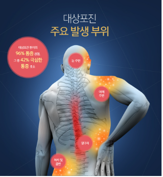 대상포진예방접종, 백신종류 비용