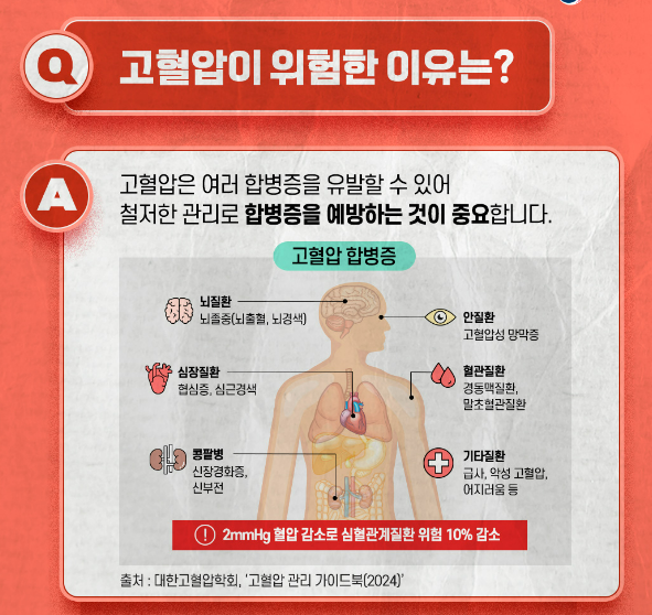 고혈압 합병증(1)