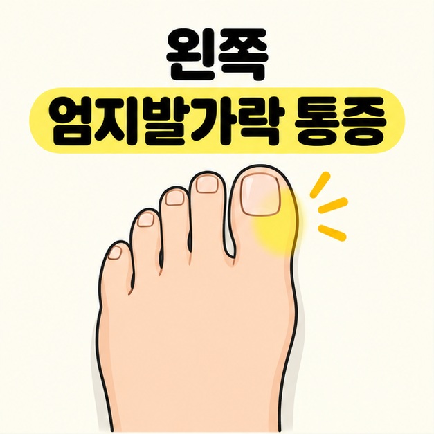 왼쪽 엄지발가락 통증이라는 제목 아래 위에서 본 왼발의 엄지 주변을 노란색으로 표시한 대표 이미지