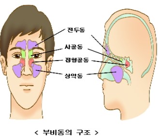 부비동염(축농증) 증상