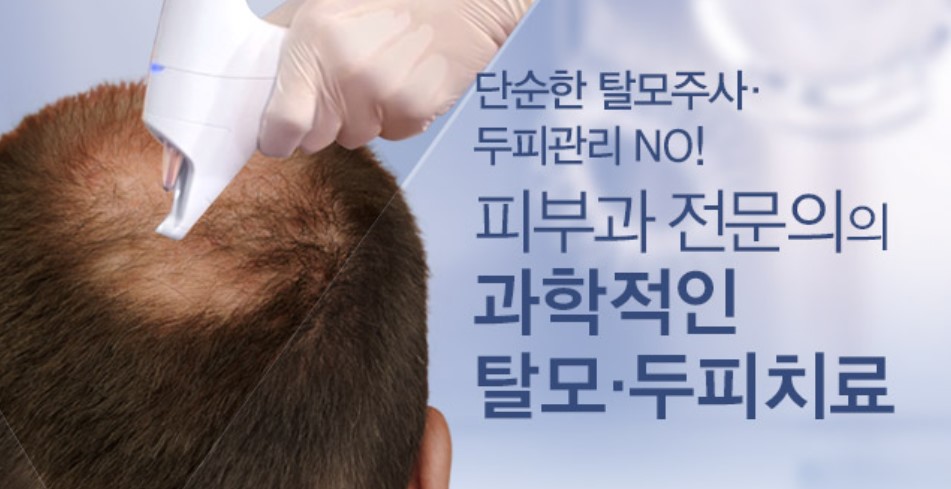 두피 레이저 탈모 치료