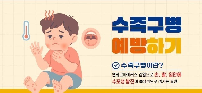 수족구병 증상.치료.일상생활
