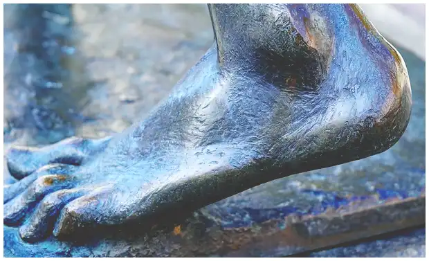 족저 근막염 치료법 (주사, 약, 걷기 중단 방법 등)