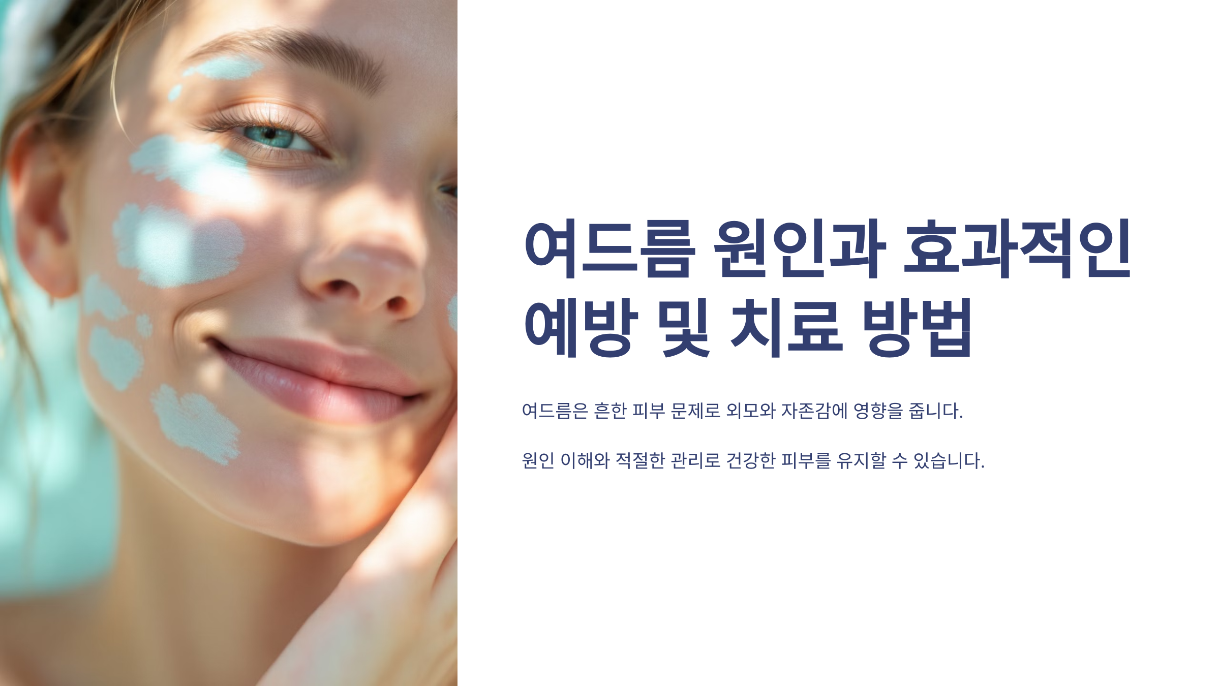 여드름 원인과 효과적인 예방 및 치료 방법