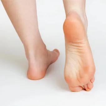 발바닥 가려움증 증상 4가지 이유 원인 치료법_12