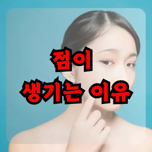 점이 생기는 이유