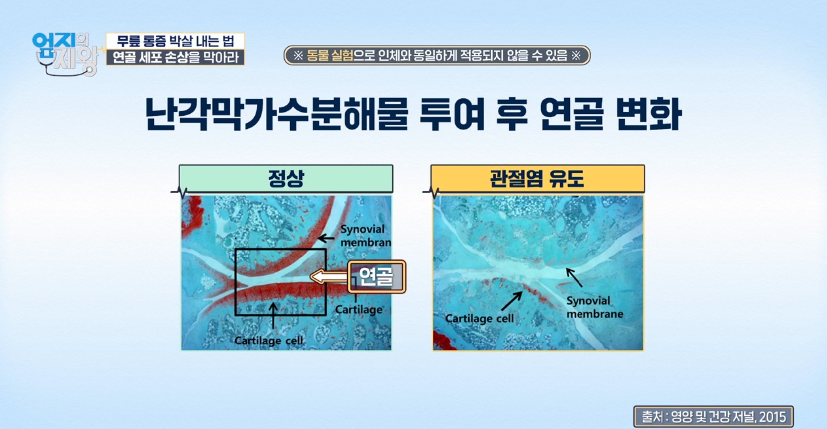 엄지의 제왕633화 무릎통증 배꼽옆 장요근 운동,연두부 레시피,난각막에 대하여