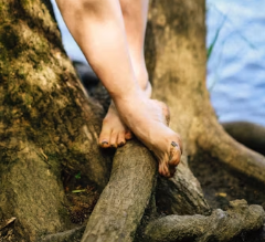 무좀 치료법 예방법 진단기준