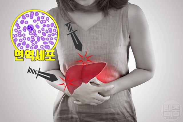 간암 원인 자가면역성간염 40대 50대 간암 예방법