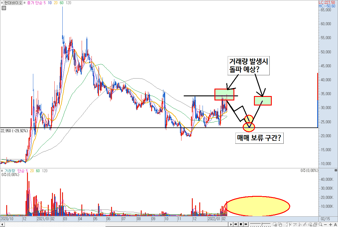 현대바이오 차트 예시 4)