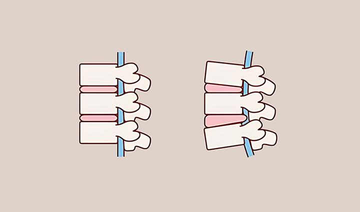 척추-신경이-움직이는-모습