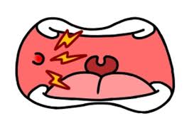 입안 염증이 생기는 이유