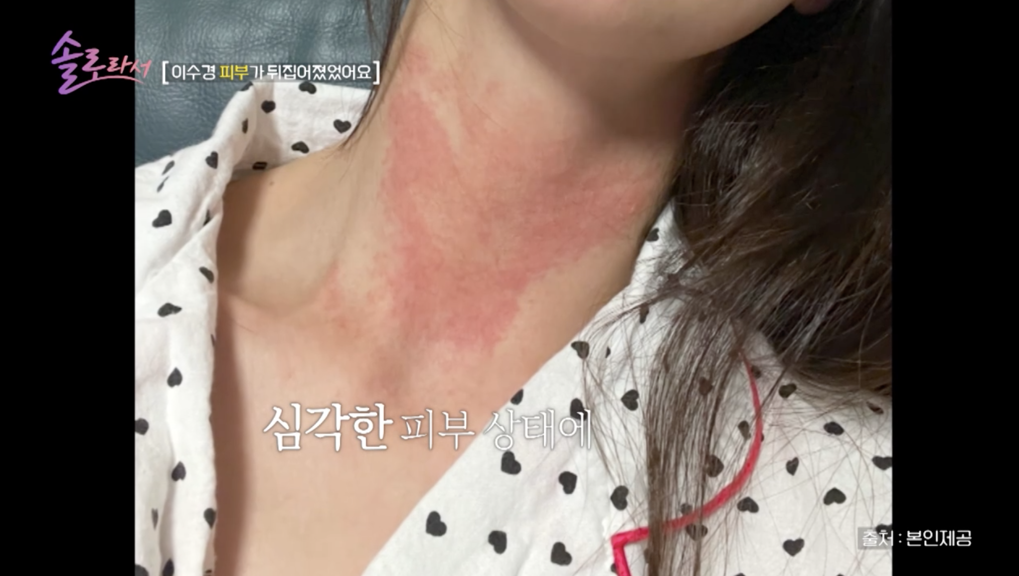 방송 '솔로라서'에 출연한 배우 이수경
