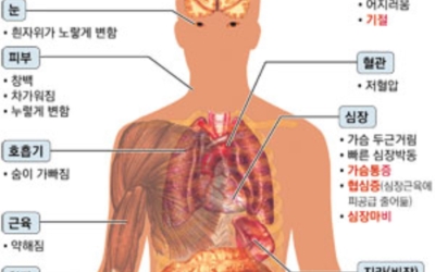 빈혈 이미지