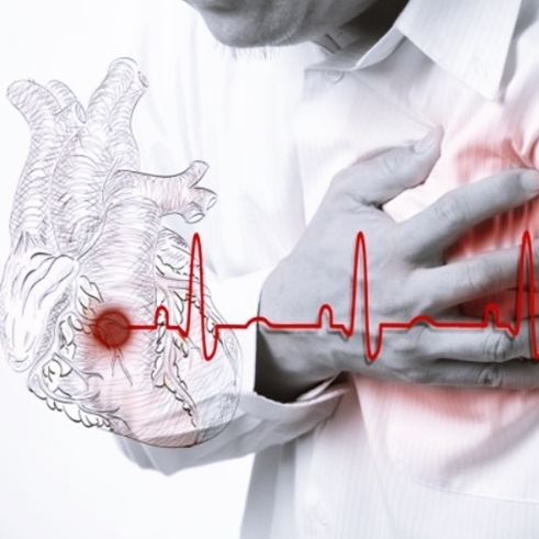 급성 심근경색 증상