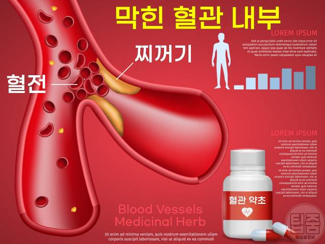 혈관에 좋은 약초 어혈 제거 효능