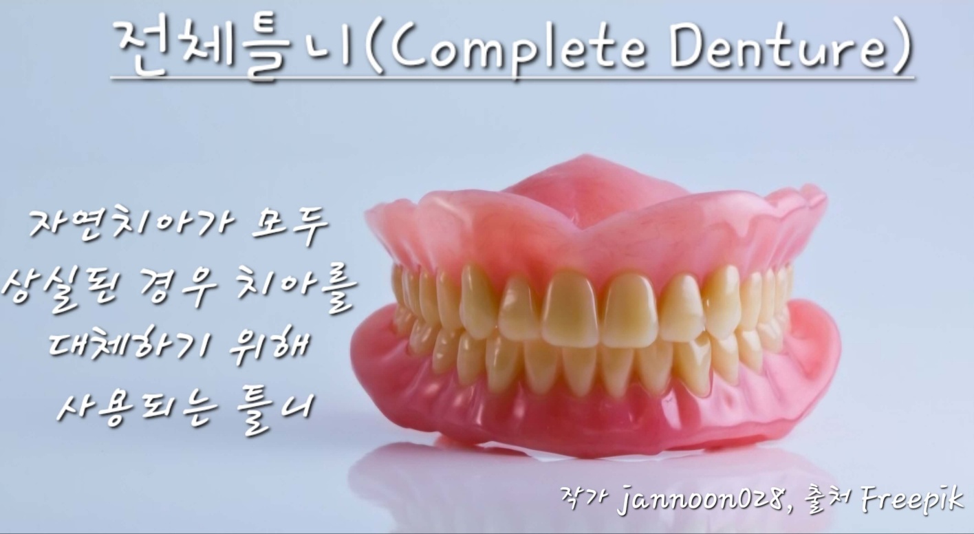 전체틀니 사진
