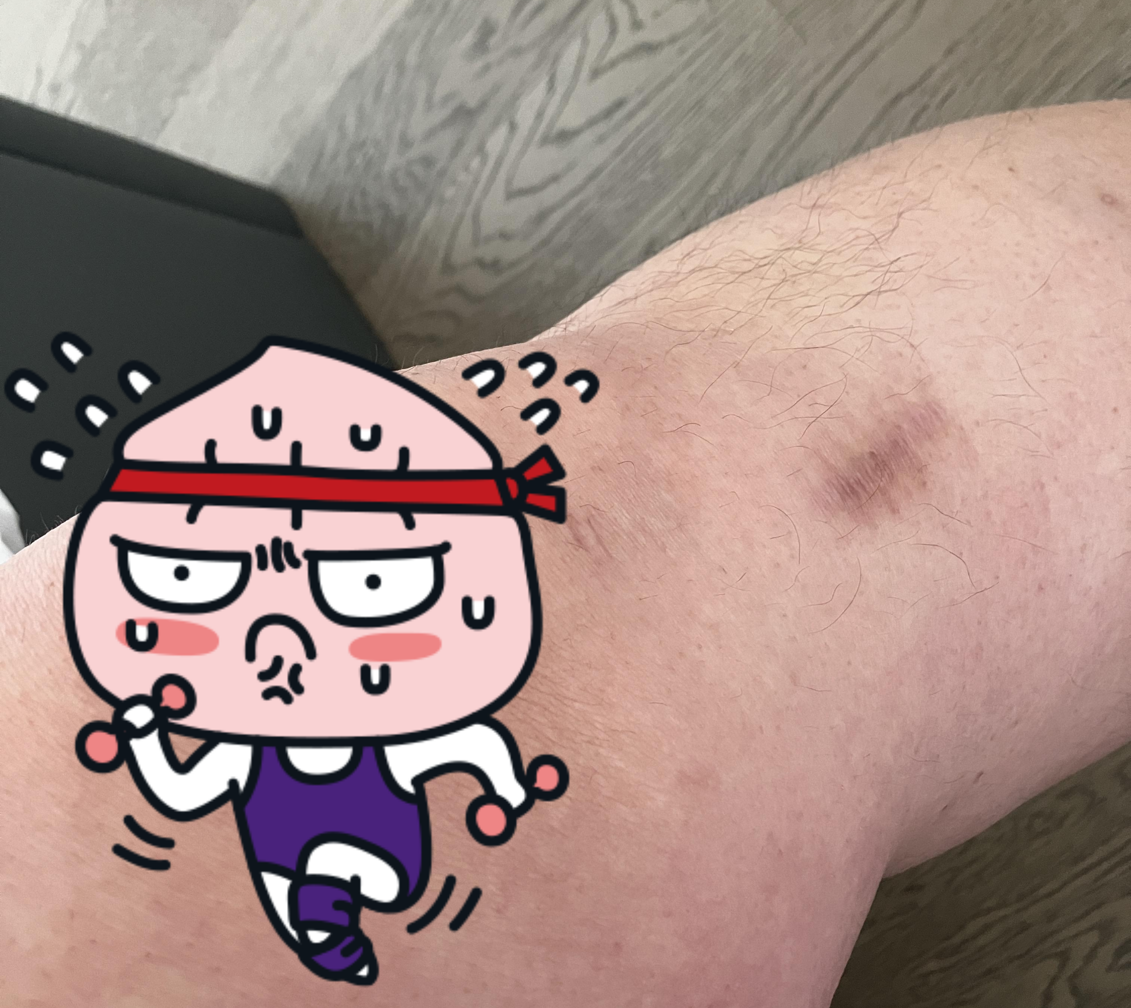 관절건강 MSM 먹는 개인적인 이유