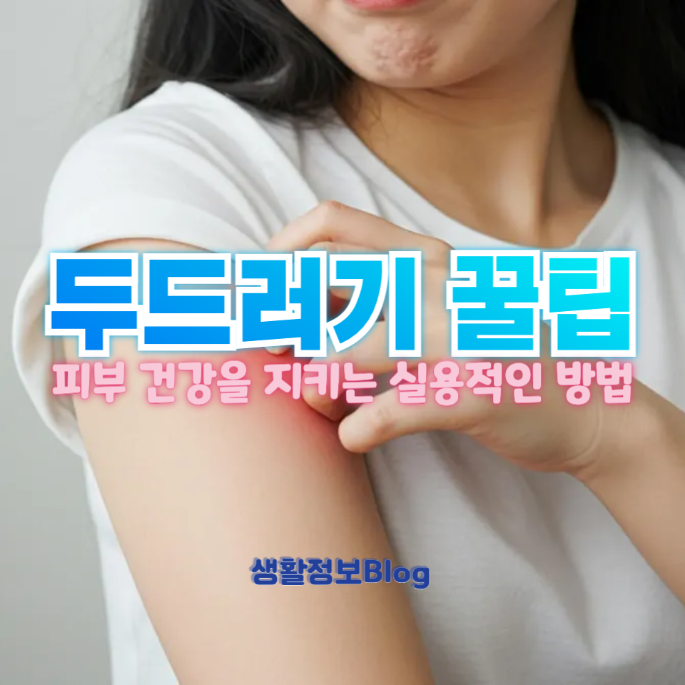 두드러기 꿀팁
