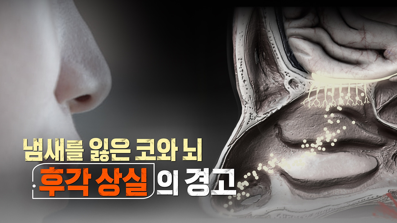 생로병사의 비밀 후각상실