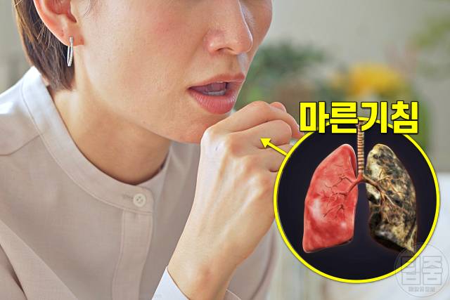 폐 굳는 병 폐섬유증 증상 마른기침 폐암 전단계 코로나후유증