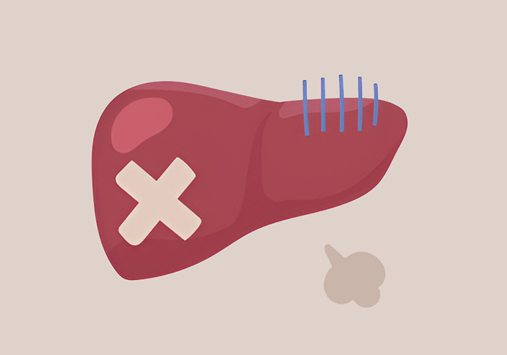 간-해독-기능-강화