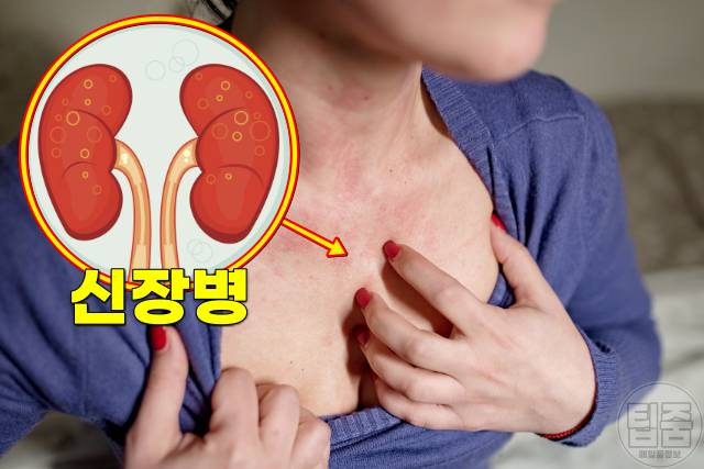 피부당김 얼굴당김 피부건조 가려움 원인 신장병