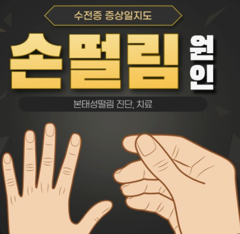 손떨림의 원인이 되는 질병들의 증상과 원인 그리고 치료 방법